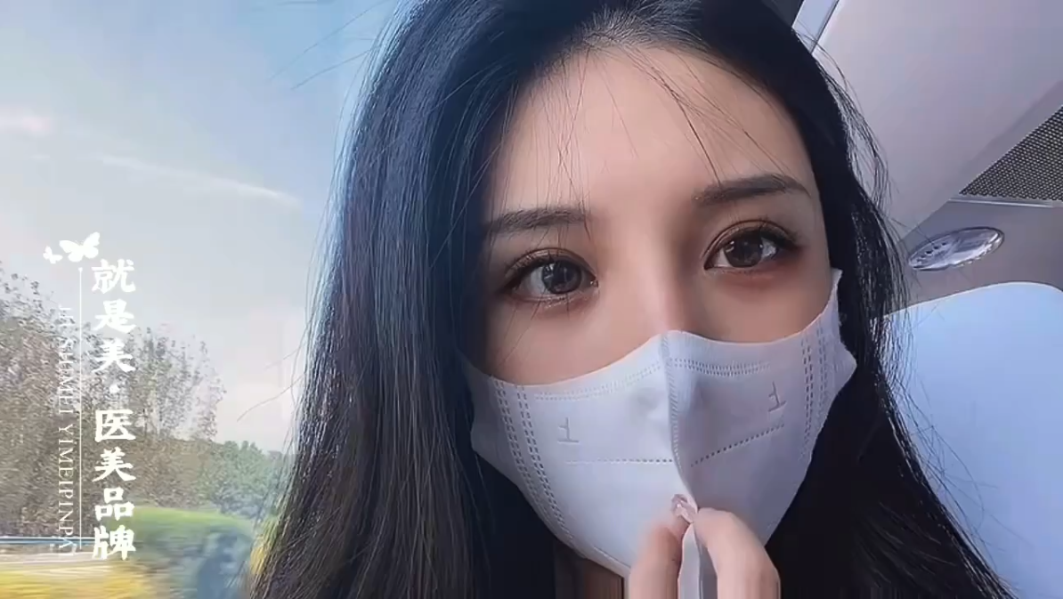 林海青医生-黄金媚眼重睑术效果